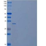 人Carbonic Anhydrase 14/CA14重组蛋白N-6His