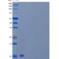 人淋巴细胞抗原6H/LY6H重组蛋白C-6His