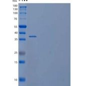 人含MANSC域蛋白1(MANSC1)重组蛋白C-6His