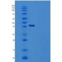 人Galactose Mutarotase/GALM重组蛋白C-6His