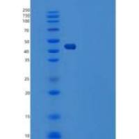 人Serpin H1重组蛋白C-6His