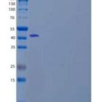 人奎宁水一号(Kininogen-1)重组蛋白