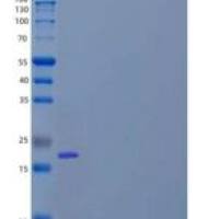 人蛋白质SCO1同源物线粒体SCO1/SCOD1重组蛋白N-GST