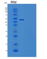 人SERPINB12重组蛋白C-6His