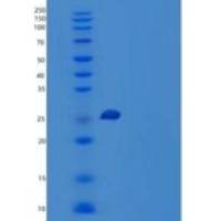小鼠激肽释放酶7(KLK7)重组蛋白