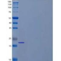 人谷氨酰胺环化转移酶/GGACT重组蛋白N-6His