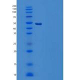 人羧肽酶M(CPM)重组蛋白C-6His