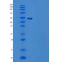 人羧肽酶M(CPM)重组蛋白C-6His