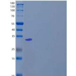 人苹果酸脱氢酶,线粒体/MDH2重组蛋白C-6His