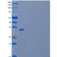 人苹果酸脱氢酶，线粒体/MDH2重组蛋白C-6His