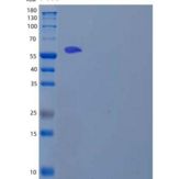 人淋巴细胞胞浆蛋白2(LCP2)重组蛋白C-6His, N-T7 tag