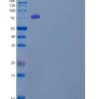 人肽基精氨酸脱亚氨酶Ⅳ(PADI4)重组蛋白N-6His