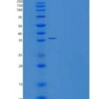 人信号传导转录激活因子5B(STAT5B)重组蛋白C-6His