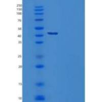 人丝氨酸蛋白酶抑制剂A3/α-1-抗糜蛋白酶重组蛋白C-6His