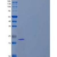 人硬骨素(SOST)重组蛋白C-6His