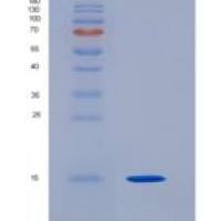 人真核翻译起始因子1B（EIF1B）重组蛋白