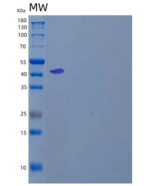 人硒代半胱氨酸裂解酶/SCLY重组蛋白N-6His