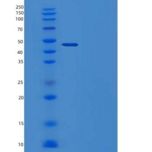 人SERPINB12重组蛋白C-6His