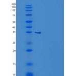 人甘氨酸-N-甲基转移酶(GNMT)重组蛋白N-6His