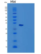 小鼠Carbonic Anhydrase 14/CA14重组