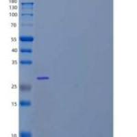 人BCAS2/DAM1重组蛋白C-6His, N-T7 tag