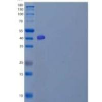 人β-1,4-半乳糖转移酶3(b4GALT3)重组蛋白C-6His
