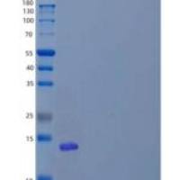 人具有免疫球蛋白和ITIM结构域蛋白/VSTM3的t细胞免疫受体重组蛋白
