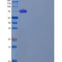 人白三烯A4水解酶(LTA4H)重组蛋白C-6His