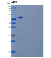 人淋巴细胞胞浆蛋白2(LCP2)重组蛋白C-6His, N-