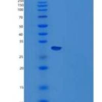 小鼠Carbonic Ahydrase 14/CA14重组蛋白N-6His