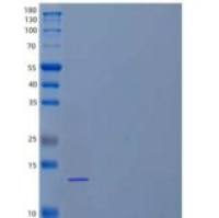 小鼠转化生长因子β-2/TGFB2重组蛋白