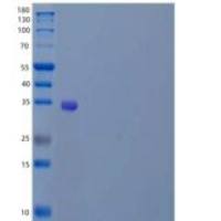 人α-可溶性NSF附着蛋白/SNAP-α/NAPA重组蛋白N-6His