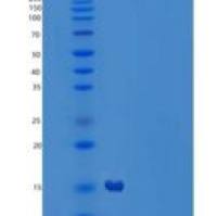 人MEK结合蛋白1/MP1/MAPKSP1重组蛋白N-6His
