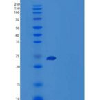 人粘蛋白-15/粘蛋白15重组蛋白C-6His