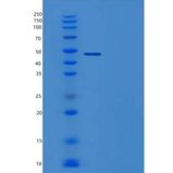 人Serpin B3/SERPINB3/SCCA1重组蛋白N-6His