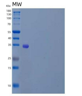 人α-可溶性NSF附着蛋白/SNAP-α/NAPA重组蛋白N