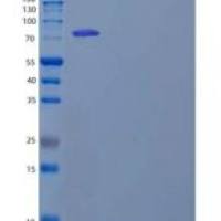小鼠谷氨酰胺转胺酶2(TGM2)重组蛋白C-6His