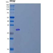 人ETS1/EWSR2/P54重组蛋白N-6His
