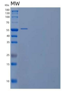 人果糖-2，6-二磷酸酶1/pfkfb 1/PFK/FBP酶