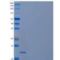 人促卵泡素β(FSHb)重组蛋白C-6His