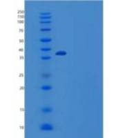 人Serpin Kazal-7/SPINK7/ECG2重组蛋白C-6His