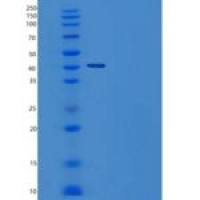 人组织蛋白酶E(CTSE)重组蛋白C-6His