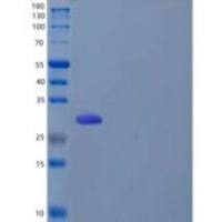 人Quinolinate Phosphoribosyltransferase/QPRTase重组蛋白N-6His
