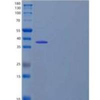 人细胞周期蛋白依赖激酶2重组蛋白