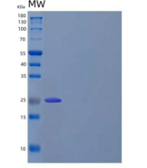 人T-细胞激活连接蛋白家族成员2(LAT2)重组蛋白C-6H