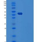 人丝氨酸蛋白酶抑制剂A5/蛋白C抑制剂重组蛋白C-6His