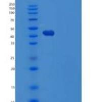 人丝氨酸蛋白酶抑制剂A5/蛋白C抑制剂重组蛋白C-6His