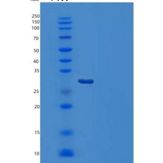 人胱天蛋白酶10(CASP10)重组蛋白C-6His