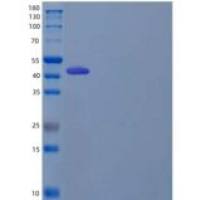 人LIM和富含半胱氨酸的结构域蛋白1/LMCD1/Dyxin重组蛋白N, C-6His