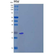 人溶菌酶G样蛋白2/LYG2重组蛋白C-6His